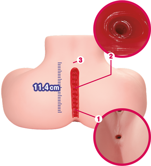 Anal tunnel cutaway
